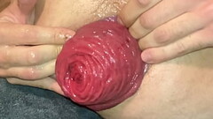 Pumping my Prolapse Thumb