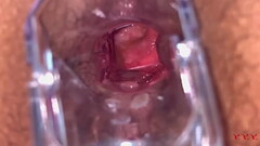 Anal Vision Speculum Thumb