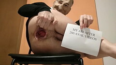 My ass after 200 extreme anal videos Thumb