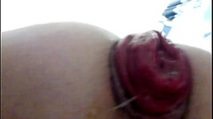 Solo Male Prolapse Part 1 Thumb